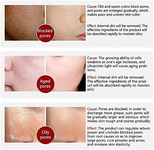 LANBENA - Skincare Serum